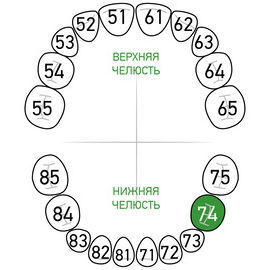 Кламп Dentech №74 для молочных зубов