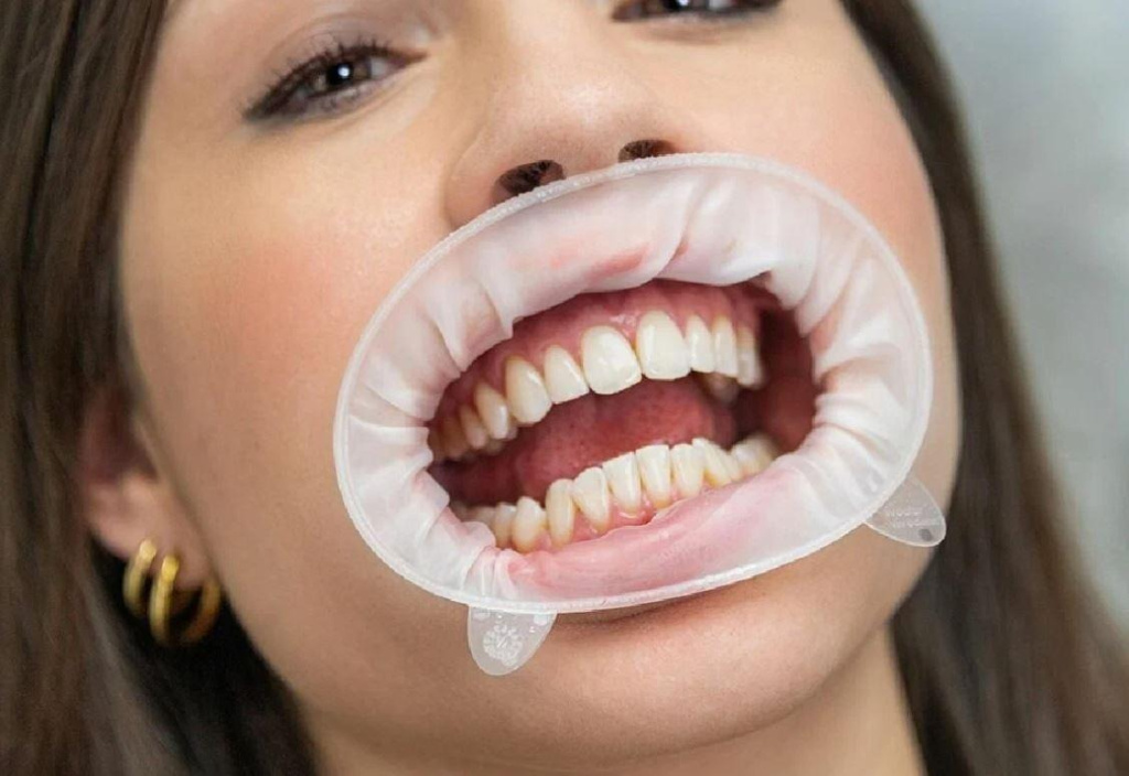 Роторасширитель