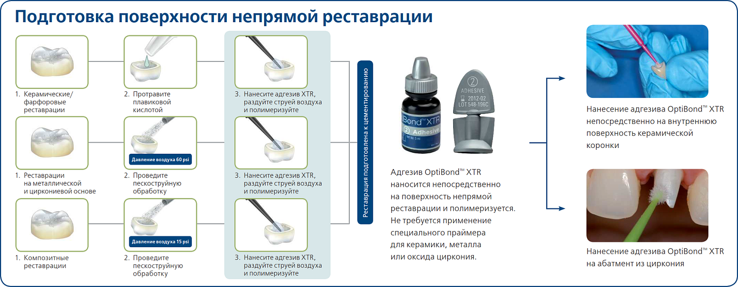 ОптиБонд XTR (OptiBond XTR) адгезив 5мл праймер 5мл Kerr