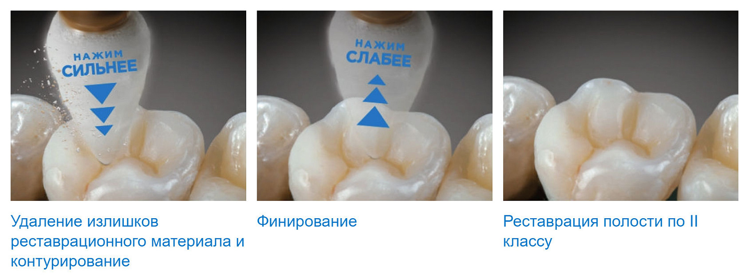 Полир Энхенс (Enhance) финишная полировка Dentsply Полир Энхенс (Enhance) финишная полировка Dentsply