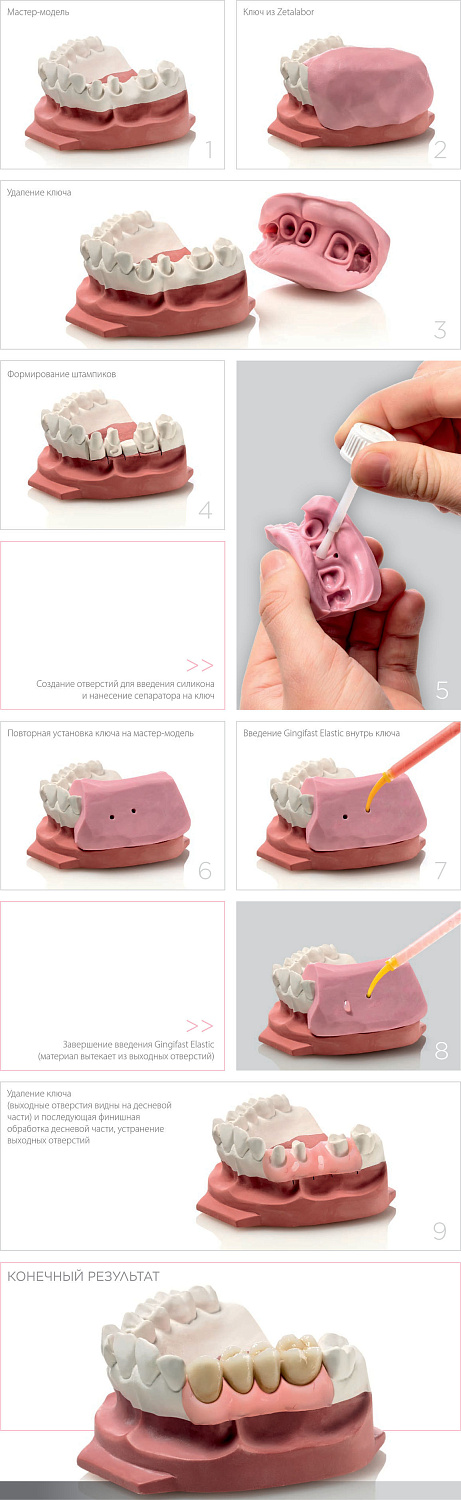 Джинджифаст Эластик (Gingifast Elastic) А-силикон 2х50мл Zhermack