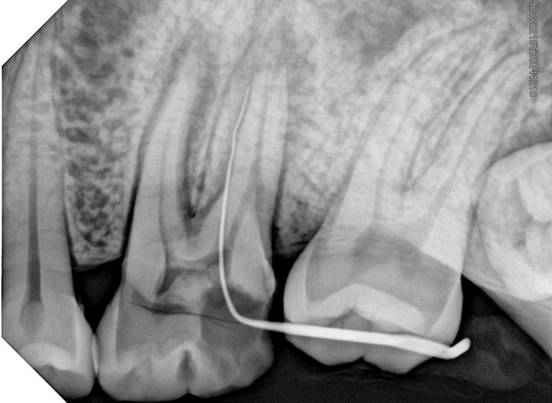 Фото товара «Радиовизиограф Handy HDR 380 (14030)» №8