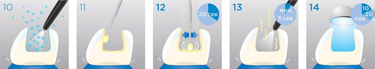 Прайм Бонд Универсал (Prime Bond Universal) адгезив Dentsply