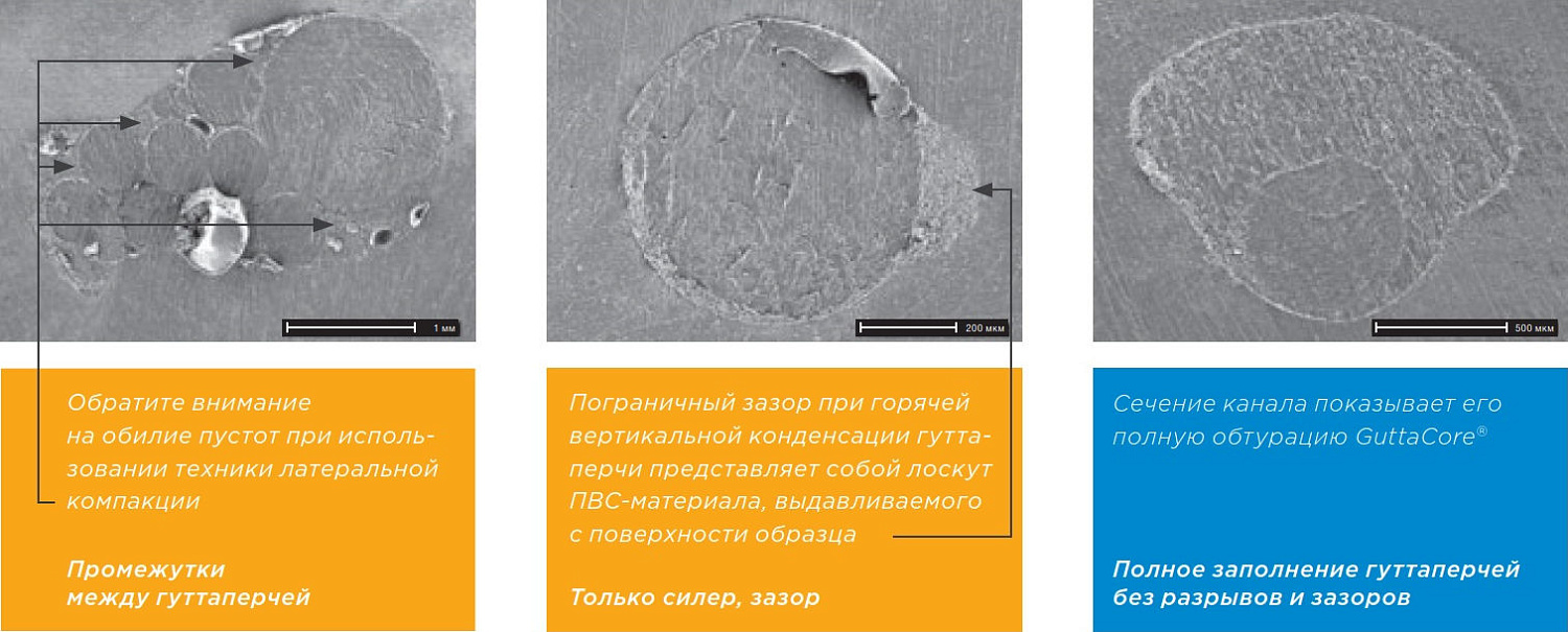 Обтураторы Dentsply GuttaCore (ГуттаКор) Обтураторы Dentsply GuttaCore (ГуттаКор)