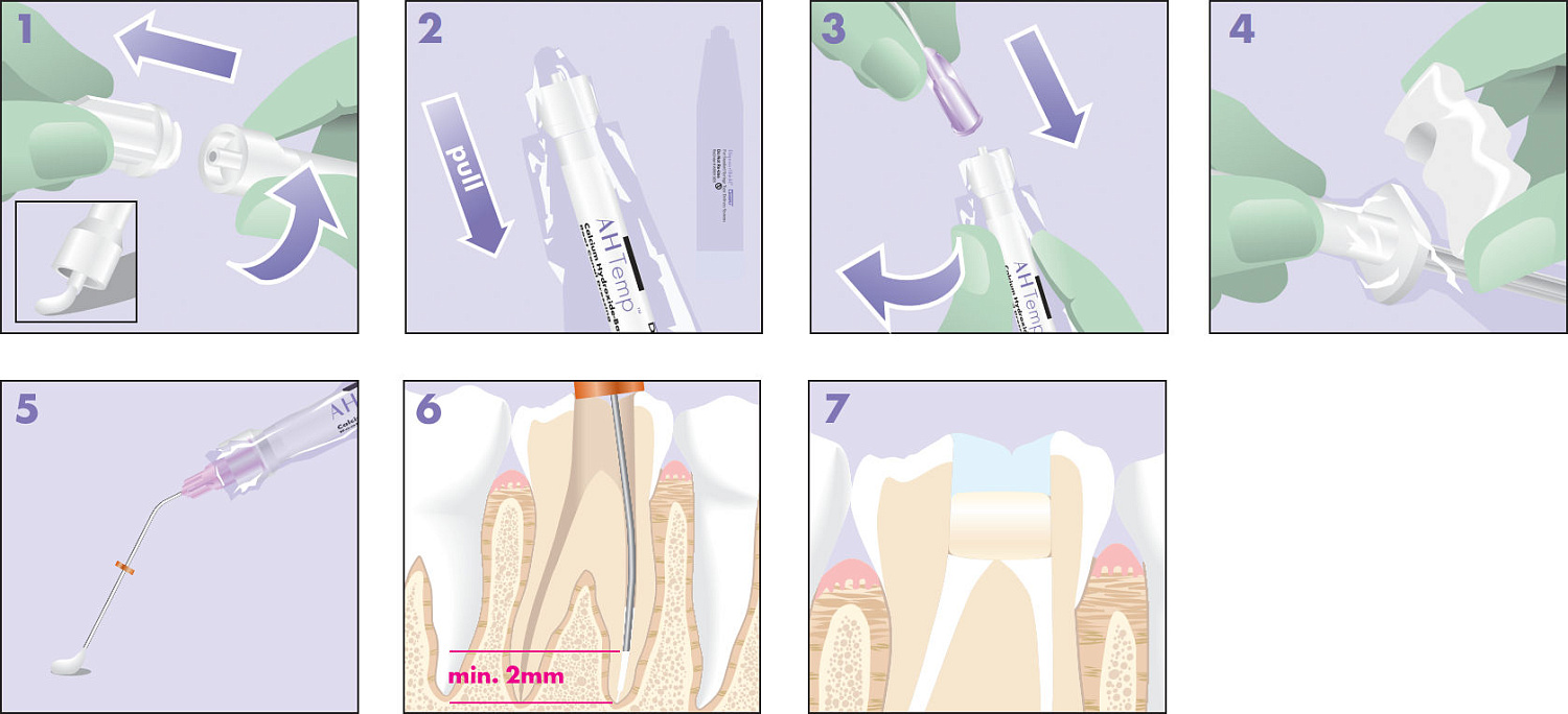 АН Темп (AH Temp) для временного пломбирования корневых каналов 4х7.5мл Dentsply 60620123