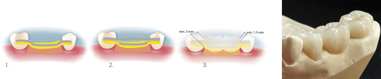 Бостон (Boston) композит световой 6г ARKONA