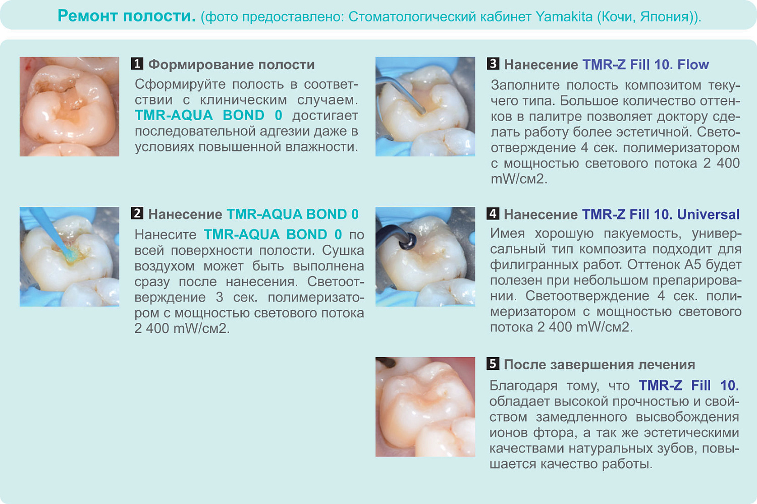 Аква Бонд (TMR Aqua Bond 0) адгезив 5мл Yamakin