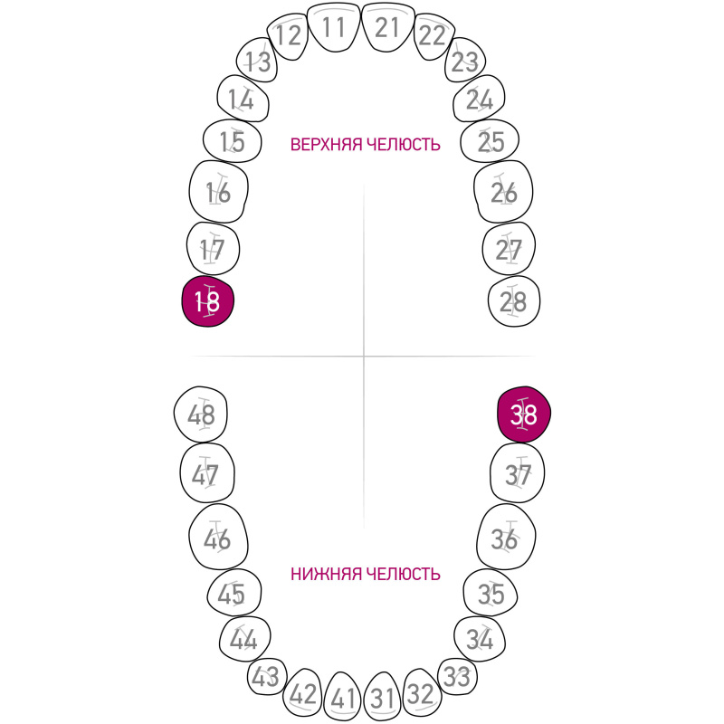 Кламп Dentech №13A для моляров тигровый