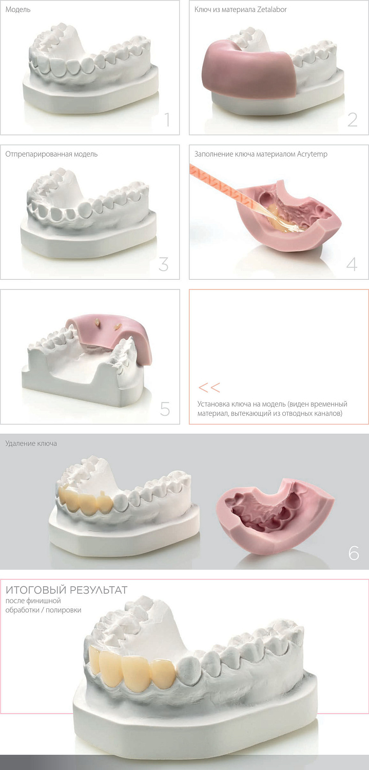 Титаниум (Titanium) С-силикон 2.6кг Zhermack