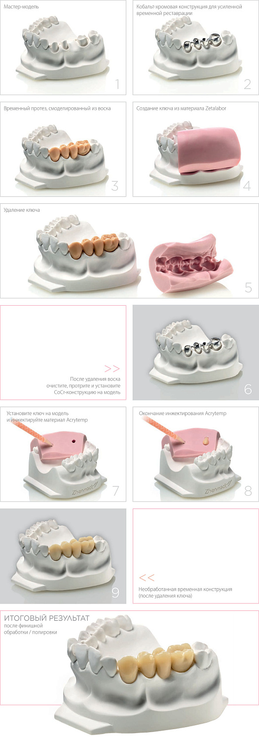 Зеталабор (Zetalabor) С-силикон Zhermack