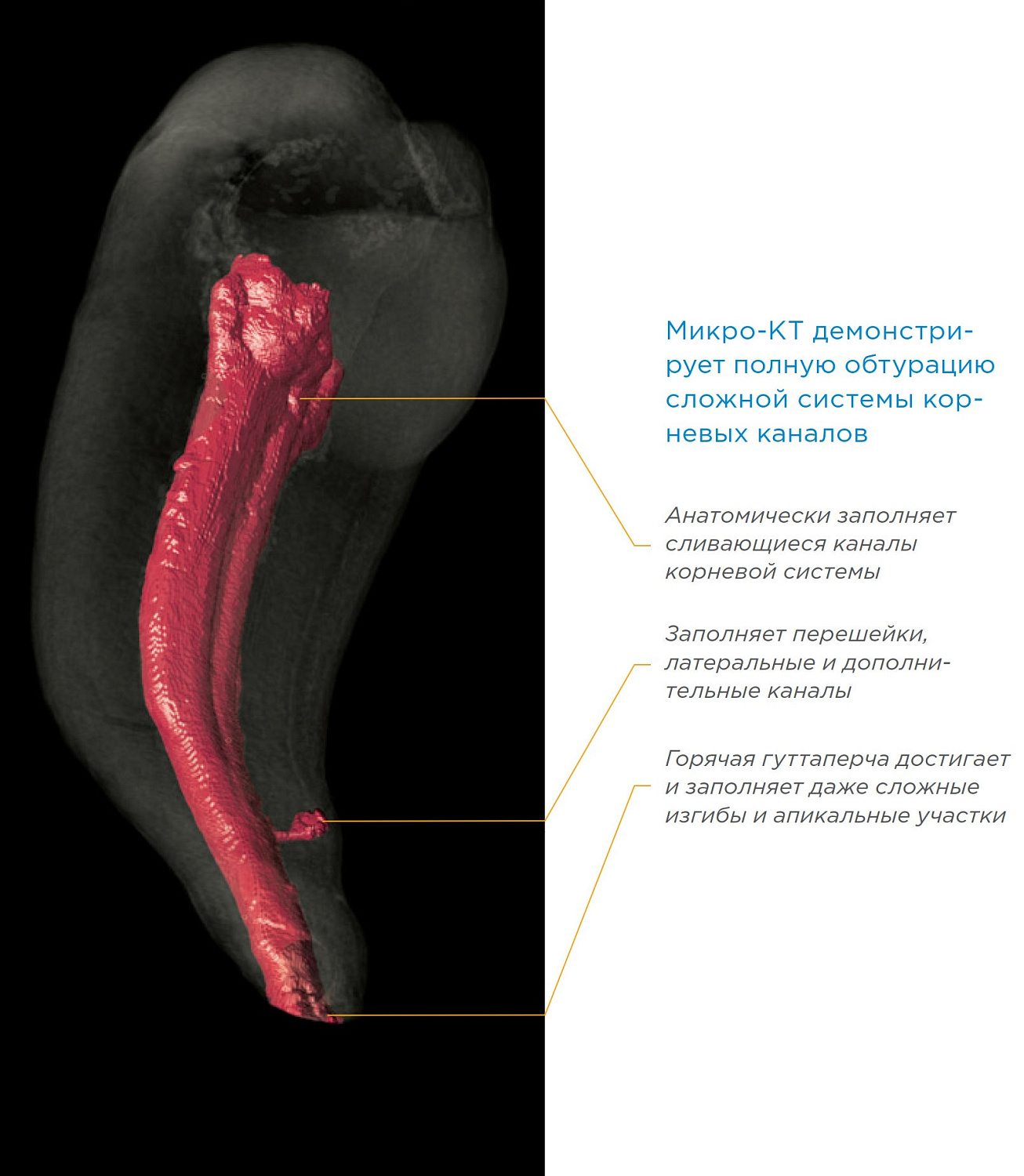 Обтураторы Dentsply GuttaCore (ГуттаКор) Обтураторы Dentsply GuttaCore (ГуттаКор)