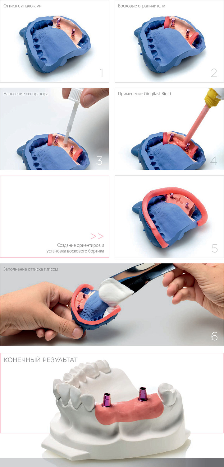 Джинджифаст Риджит (Gingifast Rigid) А-силикон 2х50мл Zhermack