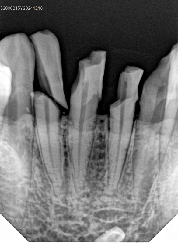 Фото товара «Радиовизиограф Handy HDR 380 (14030)» №6