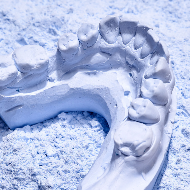 Супергипс Denston 3 класс 20кг Duradent