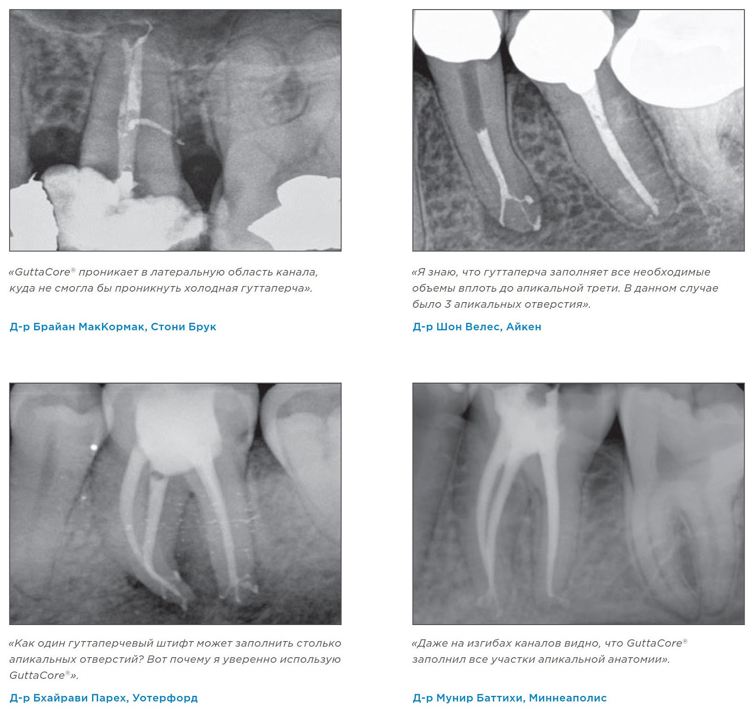 Обтураторы Dentsply GuttaCore (ГуттаКор) Обтураторы Dentsply GuttaCore (ГуттаКор)