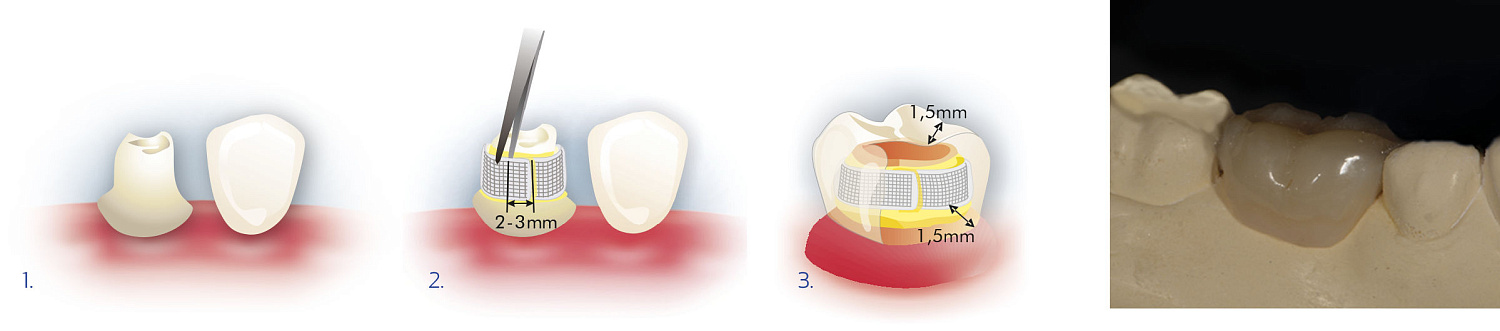 Бостон (Boston) композит световой 6г ARKONA